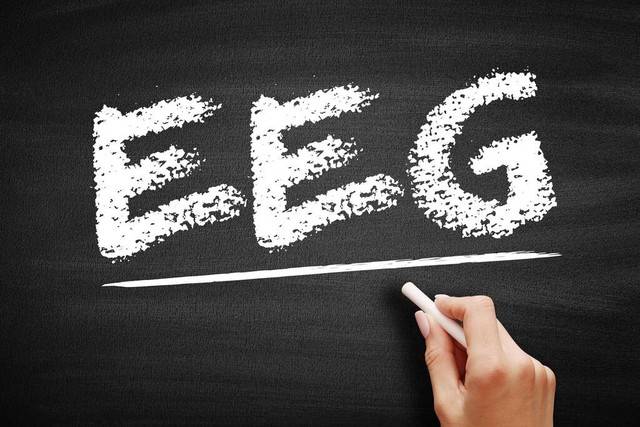 神经电生理脑电图技术考试有没有什么好的刷题软件或资料啊<strong></p>
<p>刷圈圈软件</strong>?