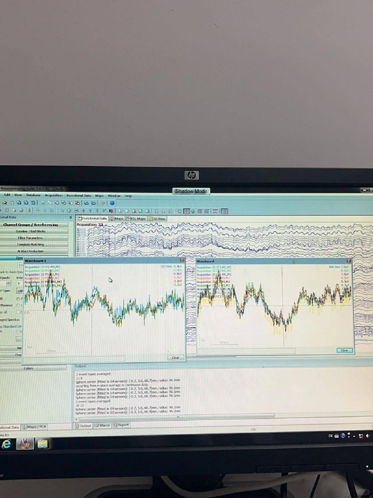 神经电生理脑电图技术考试有没有什么好的刷题软件或资料啊<strong></p>
<p>刷圈圈软件</strong>?