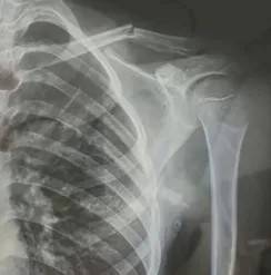 赤峰市教育局介入<strong></p>
<p>eth币多少一个</strong>，家长称：孩子拨弄开关被另一班班主任打伤