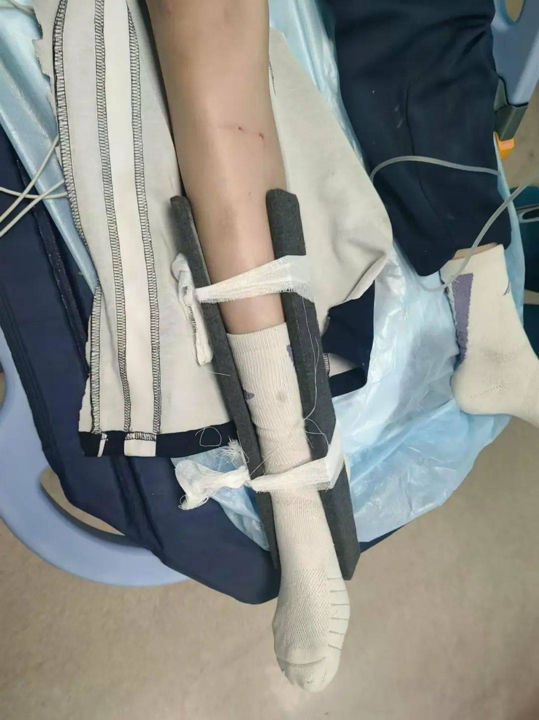 惨痛<strong></p>
<p>eth币今日价格</strong>！一人身亡！深圳多名学生骑电动车发生意外