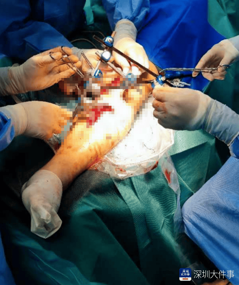 失血过半！深圳男子被三四百斤模具砸到<strong></p>
<p>利率是货币的价格</strong>，医生全力抢救