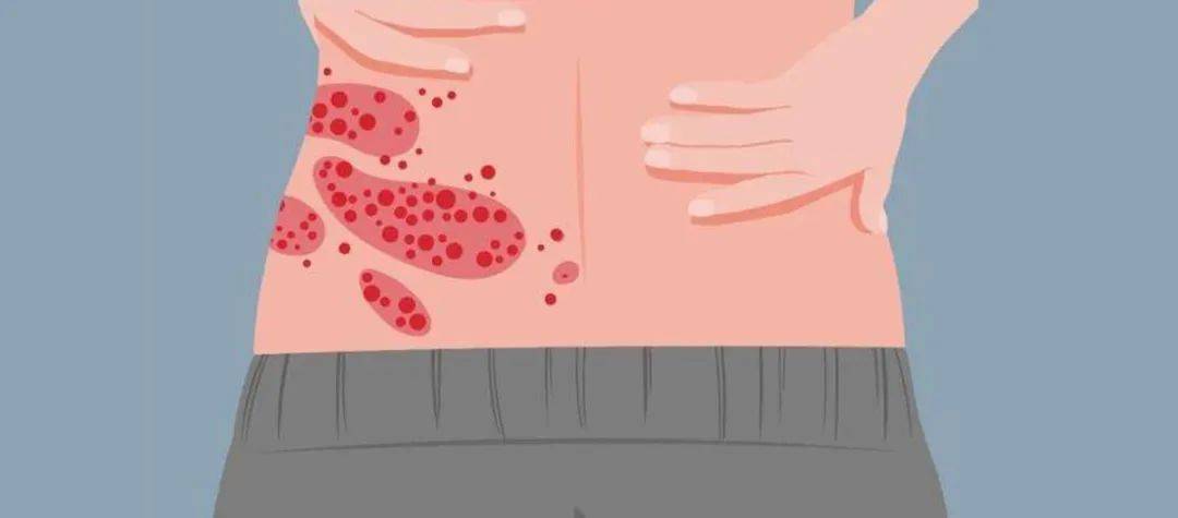 一旦感染终身携带<strong></p>
<p>币圈交易30秒看涨跌</strong>!深圳疾控提醒:这4类人要注意