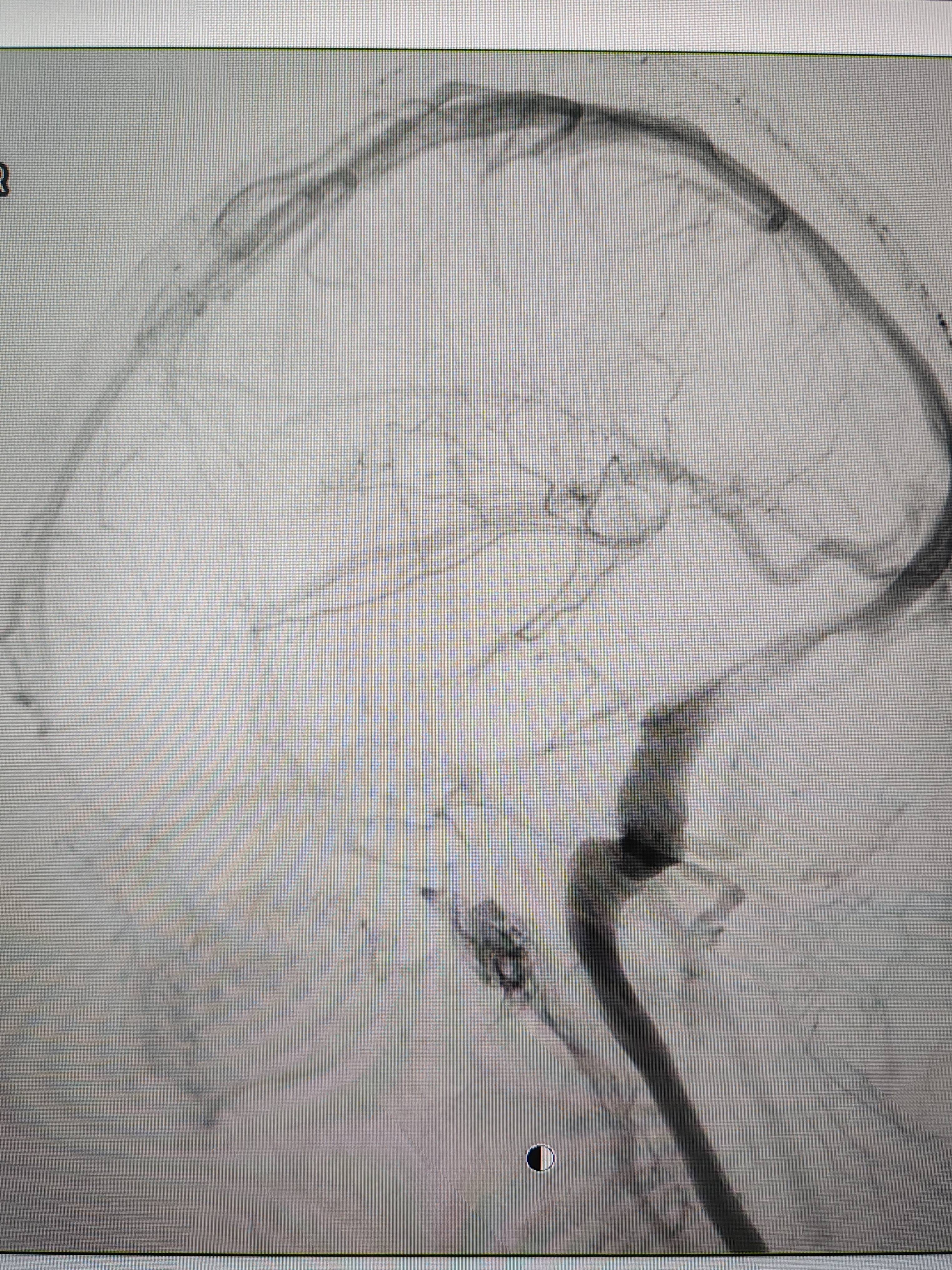 吉林女子患罕见耳鸣7年<strong></p>
<p>本质是商品</strong>,慕名千里来顺德寻医终获新生