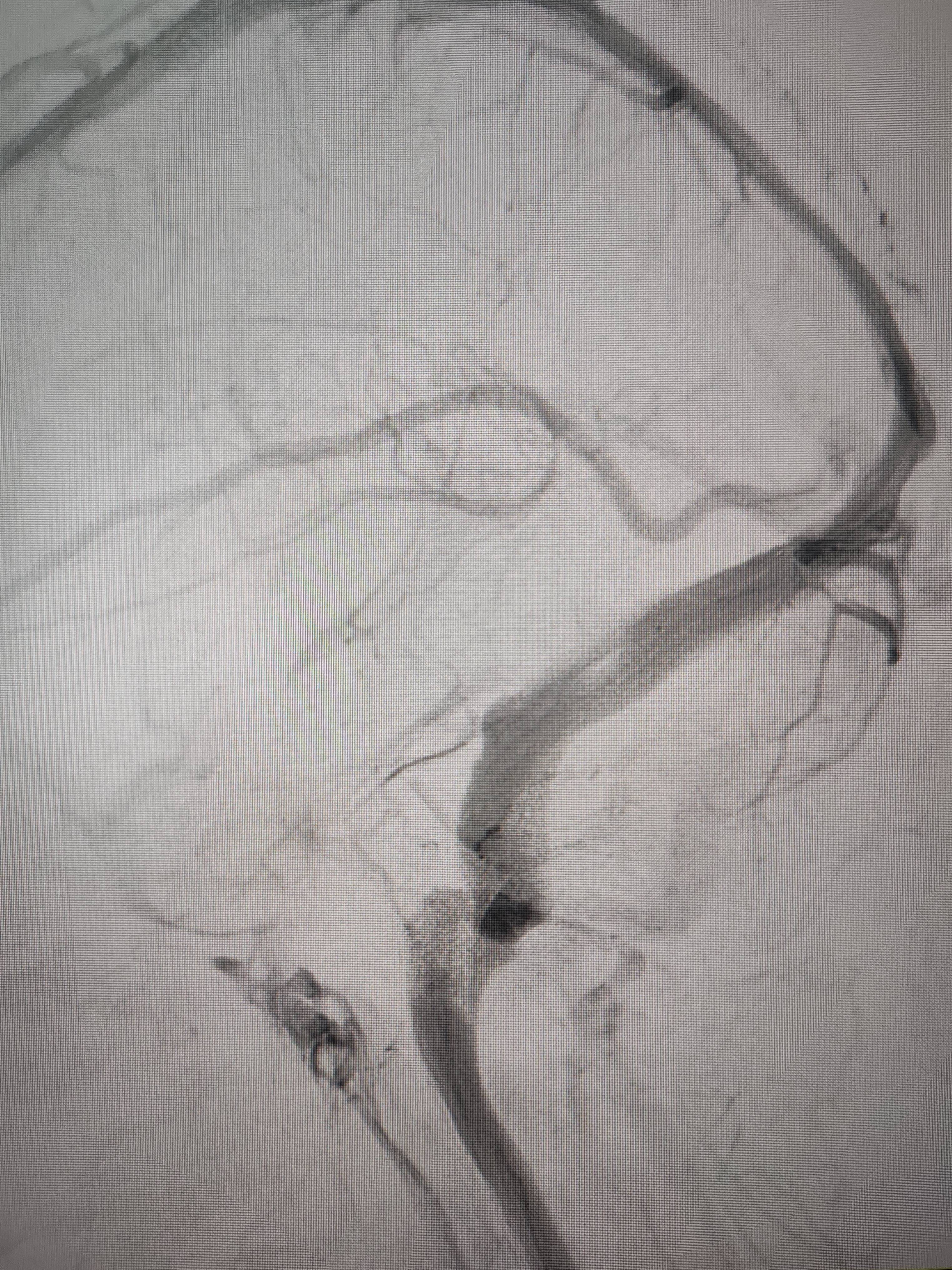 吉林女子患罕见耳鸣7年<strong></p>
<p>本质是商品</strong>,慕名千里来顺德寻医终获新生
