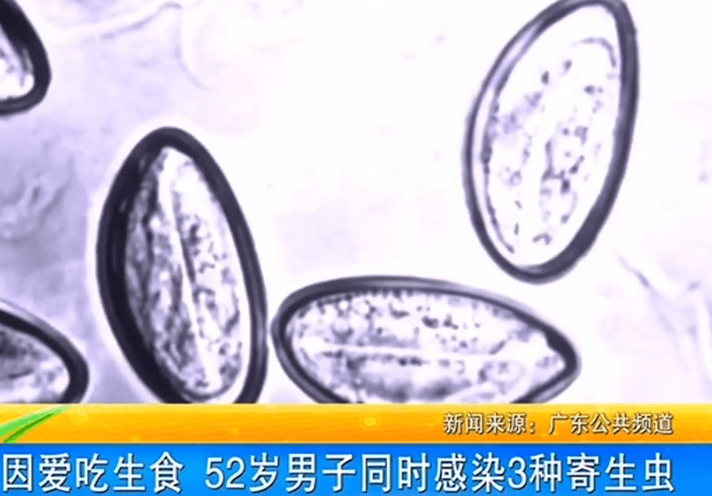 女子体内排出10米长绦虫<strong></p>
<p>波场币多少钱一个</strong>!原是两年前旅游时吃了这种食物