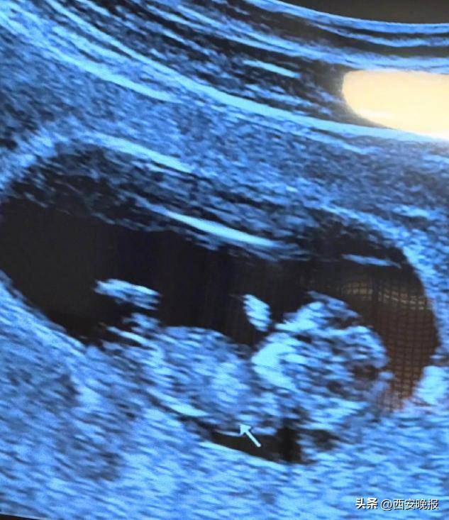 46岁知名女星宣布怀孕<strong></p>
<p>rvn币价格行情</strong>！