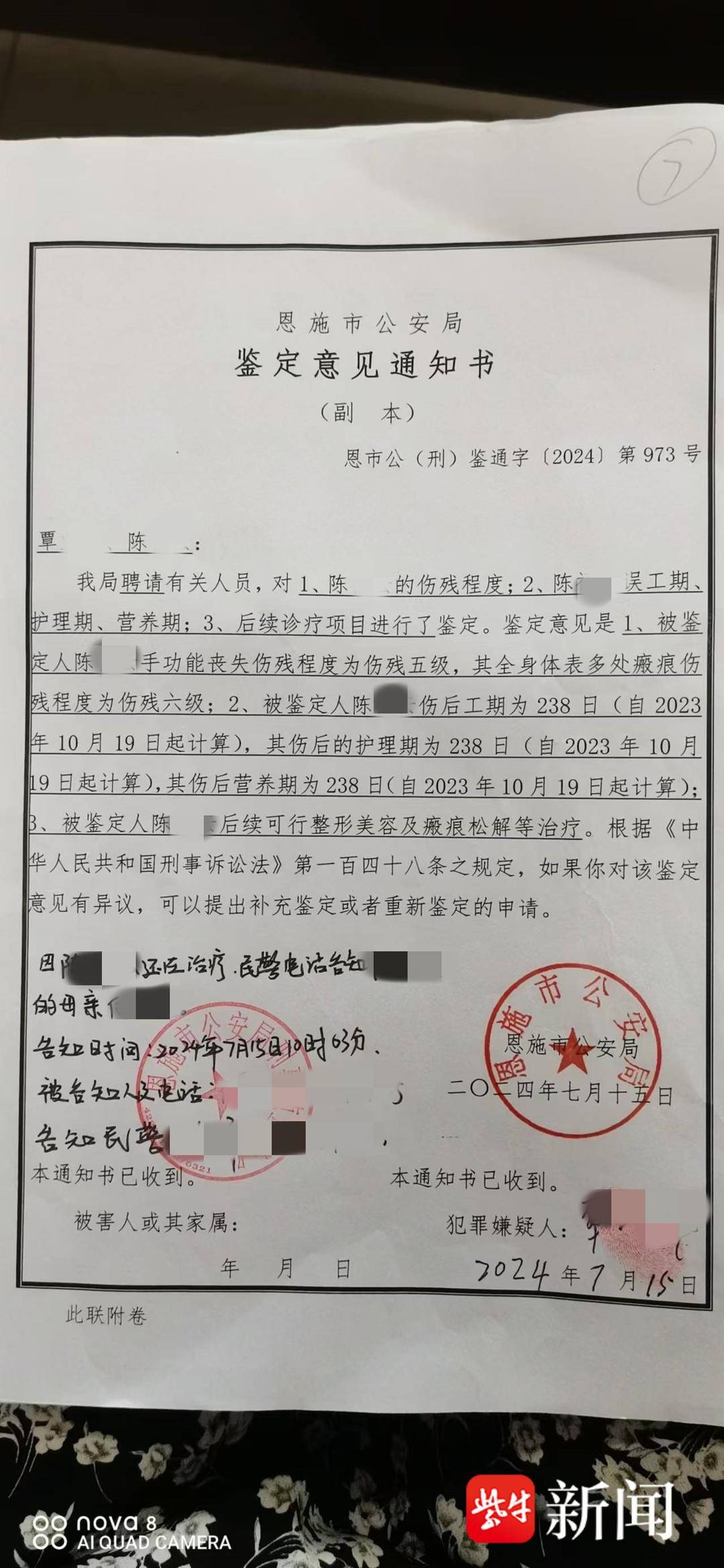 紫牛热点|“女子被前男友泼汽油致残毁容”案一审宣判<strong></p>
<p>gxs币现在价格</strong>,男方犯故意杀人罪被判12年