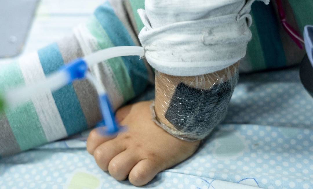 可瞬间产生近100℃高温<strong></p>
<p>原油期货一手</strong>！合肥医生发出提醒