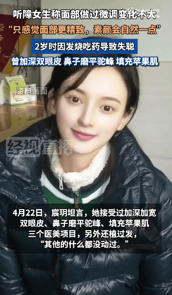 “美院聋哑女生因长相太完美”登热搜第一<strong></p>
<p>原油cl</strong>,本人承认微调:不太上镜,比照片视频好看