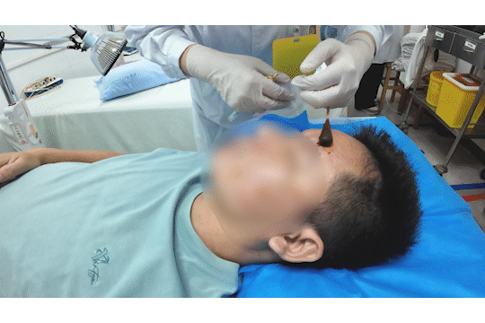 醒来“天塌了”<strong></p>
<p>原油期货怎么样</strong>!深圳一女子眼睛闭不上、嘴巴漏水!这些错误很多人会犯