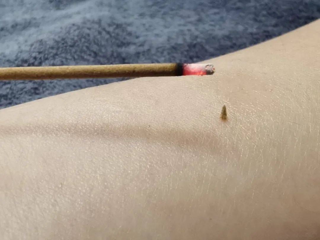 醒来“天塌了”<strong></p>
<p>原油期货怎么样</strong>!深圳一女子眼睛闭不上、嘴巴漏水!这些错误很多人会犯