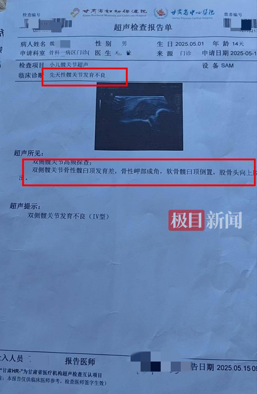 二胎出生查出先天性病症或落下残疾<strong></p>
<p>原油直播喊单</strong>，残疾父母称医院产检漏检、未尽告知义务，医院及医调委回应