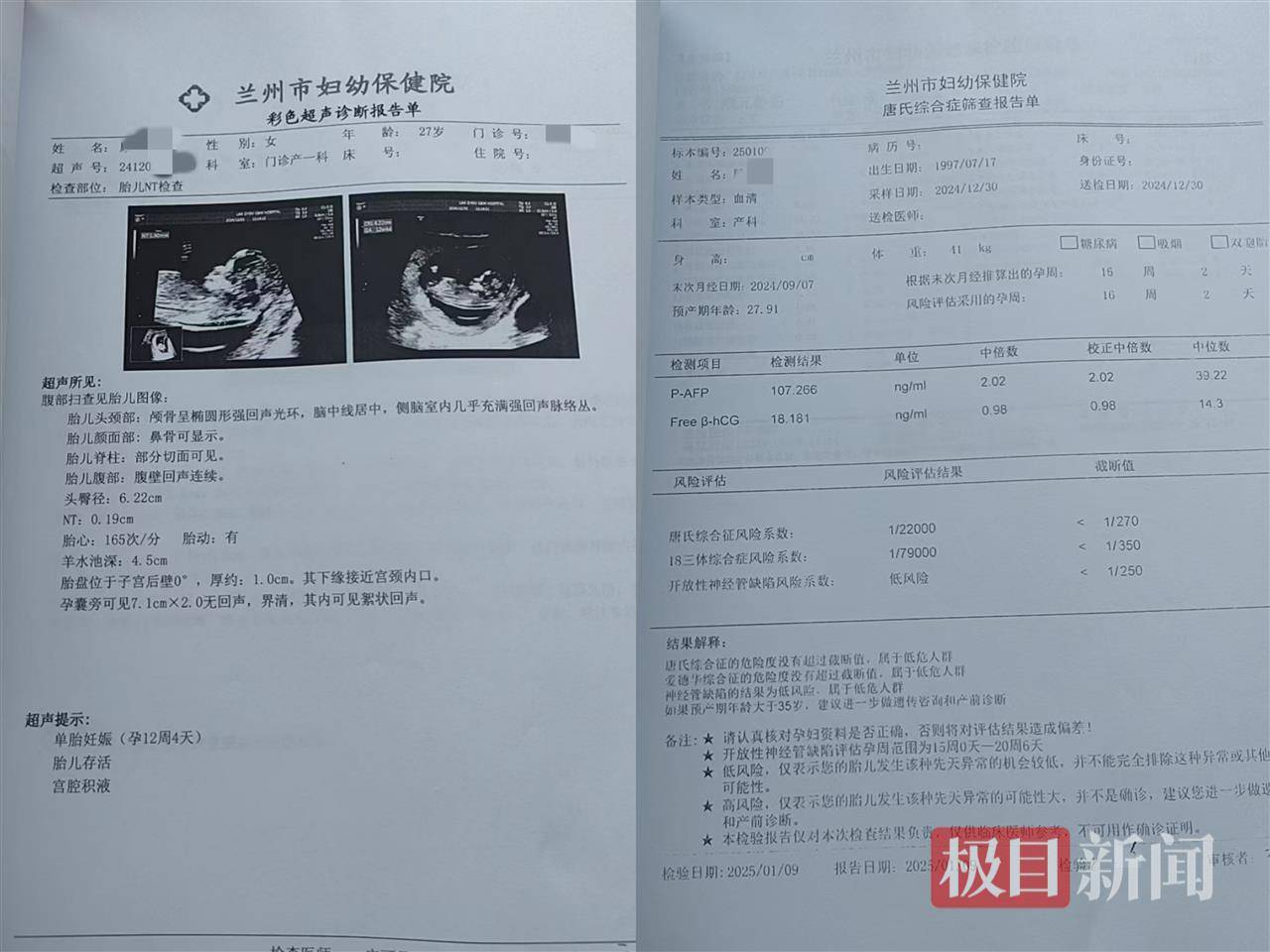 二胎出生查出先天性病症或落下残疾<strong></p>
<p>原油直播喊单</strong>，残疾父母称医院产检漏检、未尽告知义务，医院及医调委回应