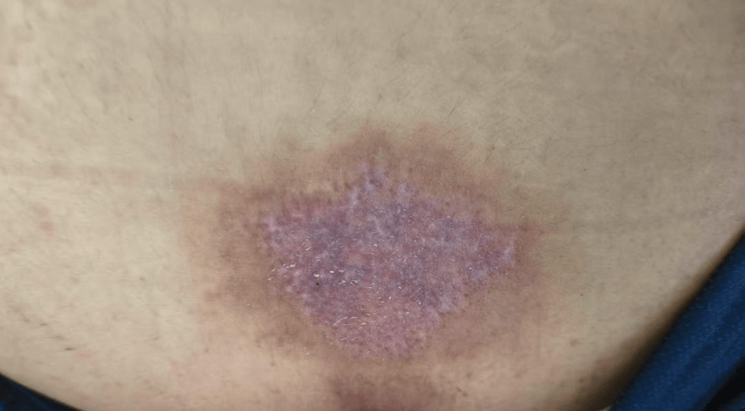 14岁女孩在拓展营遭体罚去世<strong></p>
<p>原油喊单直播</strong>，班主任因截留其给父母信件受审