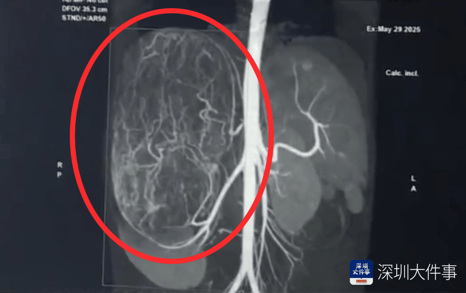 店员试衣间里一句警告<strong></p>
<p>原油进口资质</strong>,竟救了17岁少女!一家人火速赶到深圳