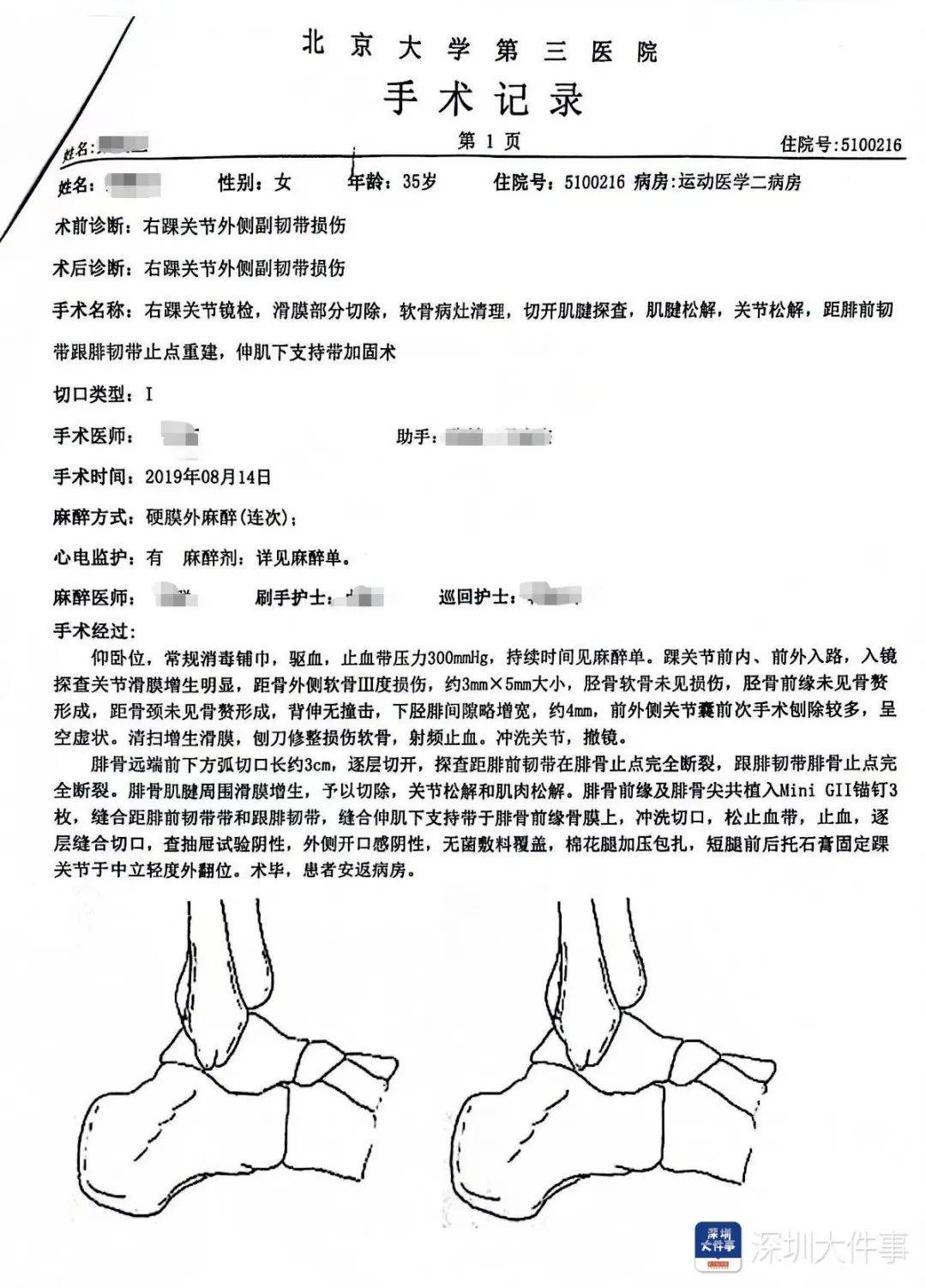 “一走路就痛”!女子脚踝受伤遭漏诊<strong></p>
<p>原油加盟</strong>,治了7年没好!深圳一医院被告上法庭