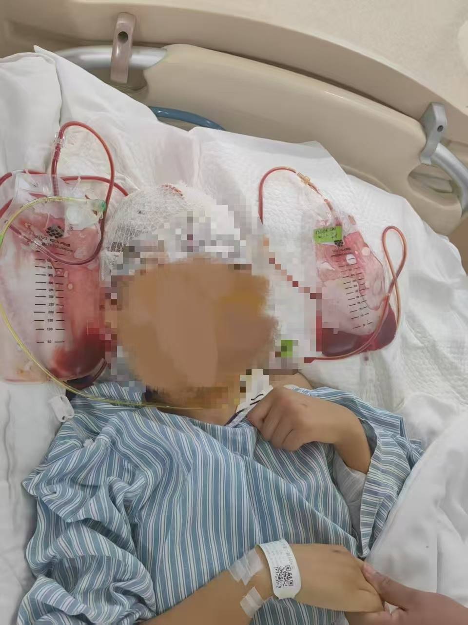 女子被车撞后昏迷4个月<strong></p>
<p>进口原油关税</strong>,母亲:交警无法定责,让起诉,这些我不懂