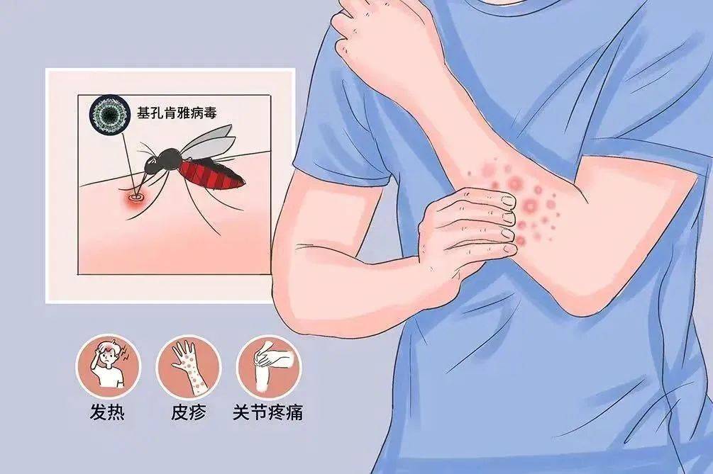 风险增大<strong></p>
<p>原油加热器</strong>!深圳疾控:去这247处要小心!张文宏首次发声