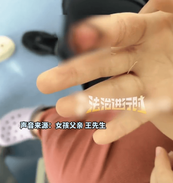 家长称7岁女儿被汗血宝马咬掉手指前端<strong></p>
<p>西原油</strong>，“一辈子带点残缺”，景区回应：X光显示未伤及骨头，已先行支付10万