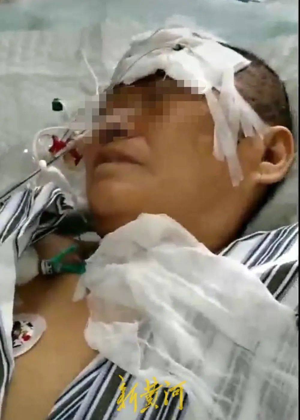 六旬老人遭狩猎者枪击致重伤<strong></p>
<p>原油股票代码</strong>,开枪者两次逃离现场,事发4小时后冒充“好心人”施救,家属:耽误了最佳救治时间