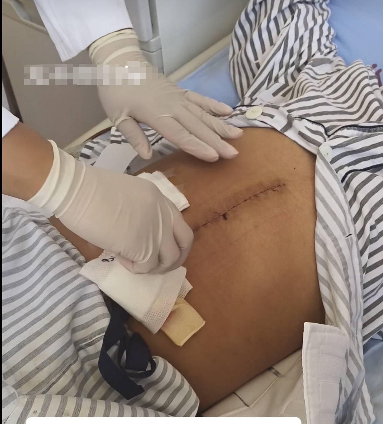 奶奶在哭<strong></p>
<p>黄金</strong>,宝宝在笑!40天女婴重病,00后父亲割肝救女,术后这一幕让网友泪奔