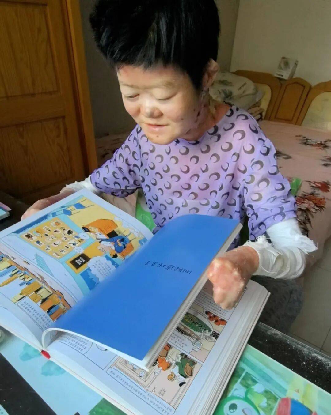 医生断言“活不过2岁”的郑州罕见病女孩<strong></p>
<p>free价格</strong>，24岁“带伤出征”，开启西藏之行