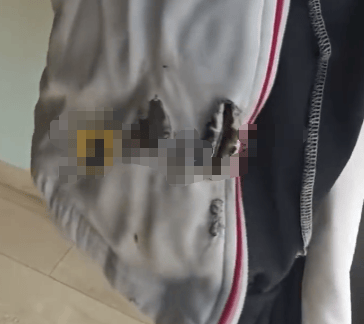 高中生散步时校服突发自燃<strong></p>
<p>传奇</strong>?原是165元网购的“宝”在惹祸→