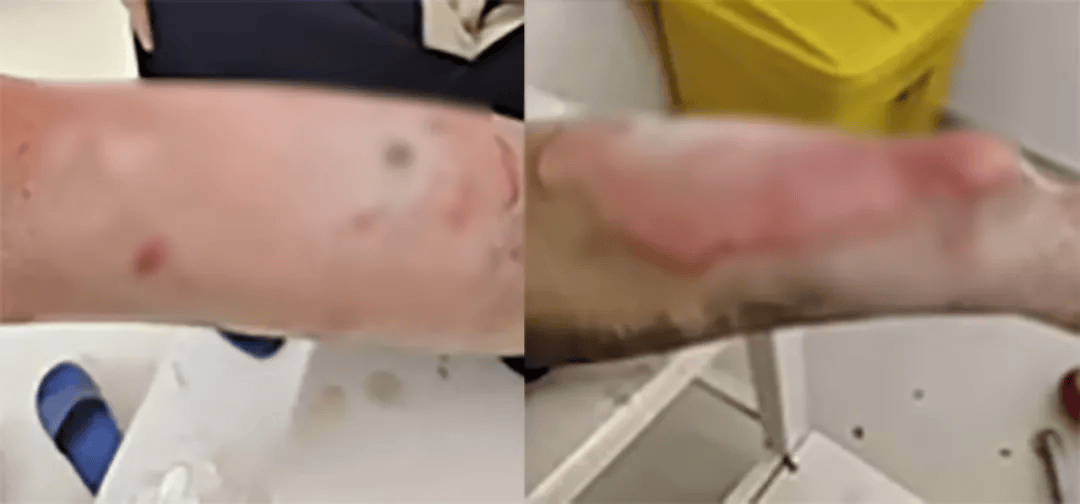 高中生散步时校服突发自燃<strong></p>
<p>传奇</strong>?原是165元网购的“宝”在惹祸→