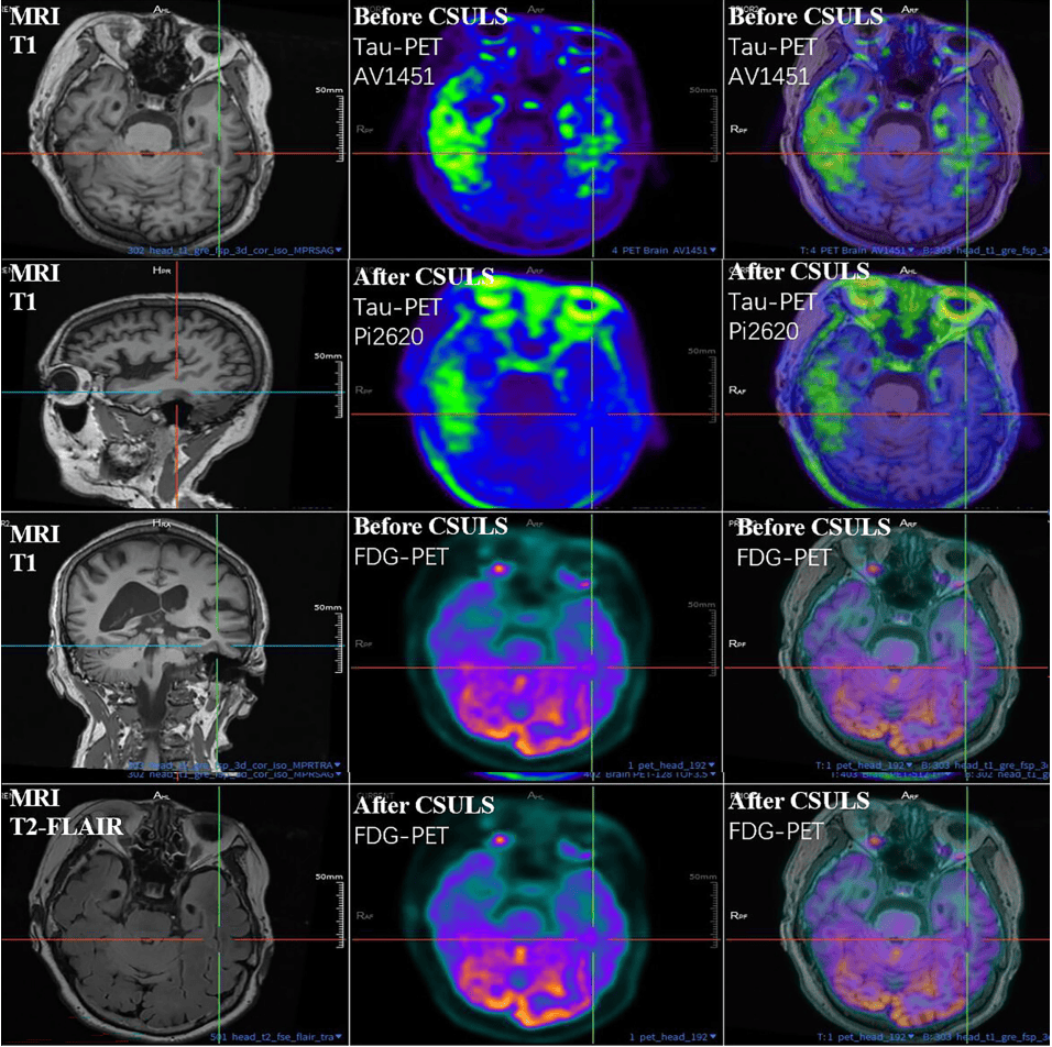 300多家医院抢着做的手术<strong></p>
<p>虚拟币otc走现金交易</strong>,为何突被禁?