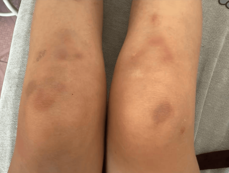 女子自称因工资问题被老板锁办公室里打 警方:双方已到派出所<strong></p>
<p>虚拟贸币</strong>,是否打人还在调查