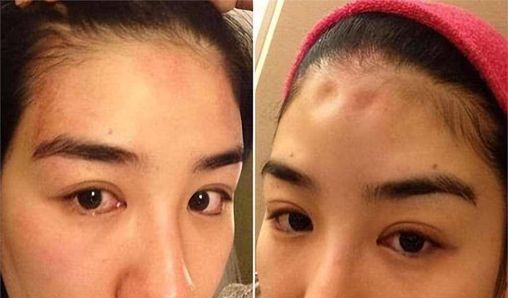 罗霖被家暴17年<strong></p>
<p>虚拟贸币</strong>,蓝洁瑛遭性侵暴力还被围观!女明星的暴力事件还有很多