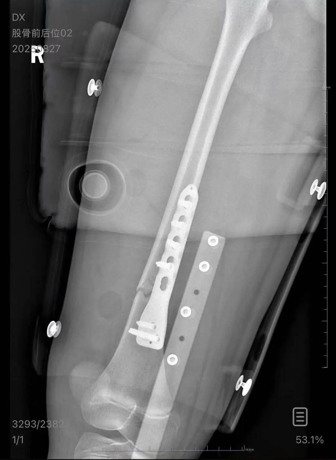 男子火车上铺跌落砸断10岁女孩腿骨<strong></p>
<p>私人挖虚拟币</strong>,回应“失联”称失业讨薪中