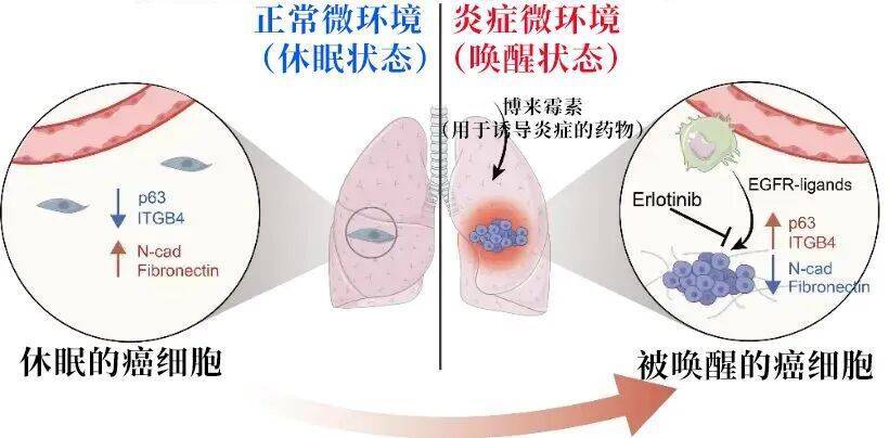 长期炎症会“唤醒”癌细胞<strong></p>
<p>私人挖虚拟币</strong>！这份抗炎指南每个人都该看看