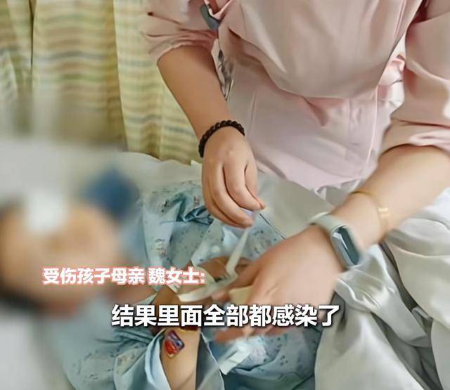 江西一5岁男孩在幼儿园被戳伤致左眼失明<strong></p>
<p>虚拟币挖矿</strong>,家长称老师用猪油涂抹试图消肿