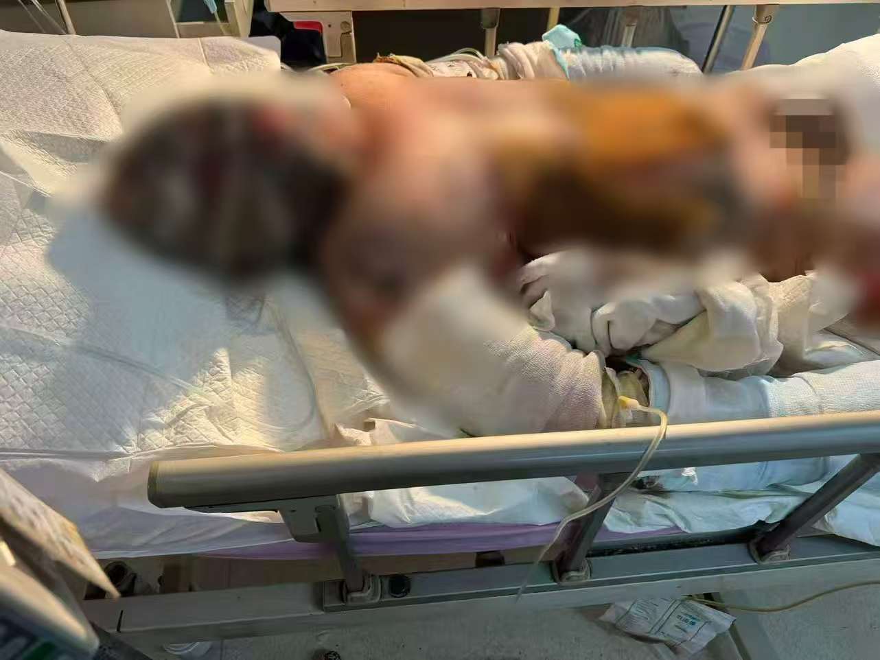 父子在哈尔滨一亲戚公司上班遇爆炸全身烧伤<strong></p>
<p>整治工作自查报告</strong>，治疗花费近百万公司拒赔偿？亲戚回应