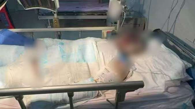 父子在哈尔滨一亲戚公司上班遇爆炸全身烧伤<strong></p>
<p>整治工作自查报告</strong>，治疗花费近百万公司拒赔偿？亲戚回应