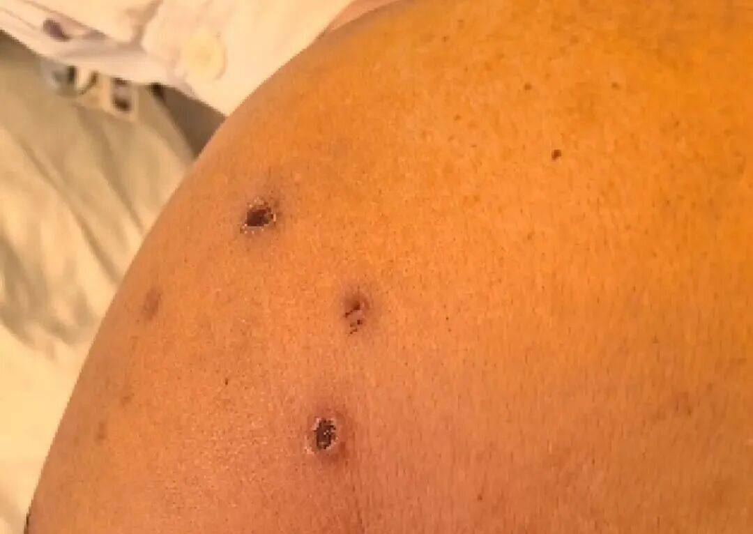 深圳一市民突遭马蜂围袭！已进入高发期<strong></p>
<p>整治工作自查报告</strong>，千万别招惹！