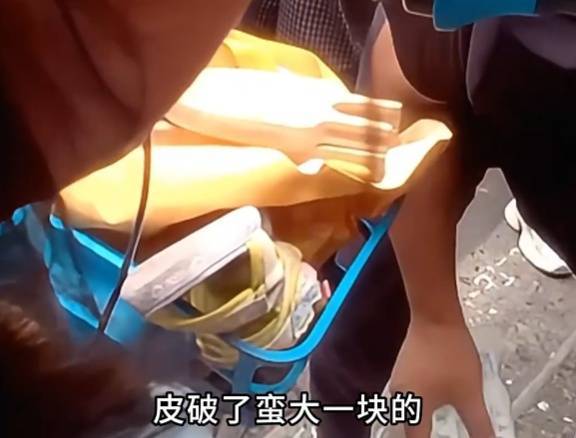 看着都疼<strong></p>
<p>虚拟币黄白线</strong>!上海街头一男子突然求助:10岁女儿被死死卡住!这个行为太危险→