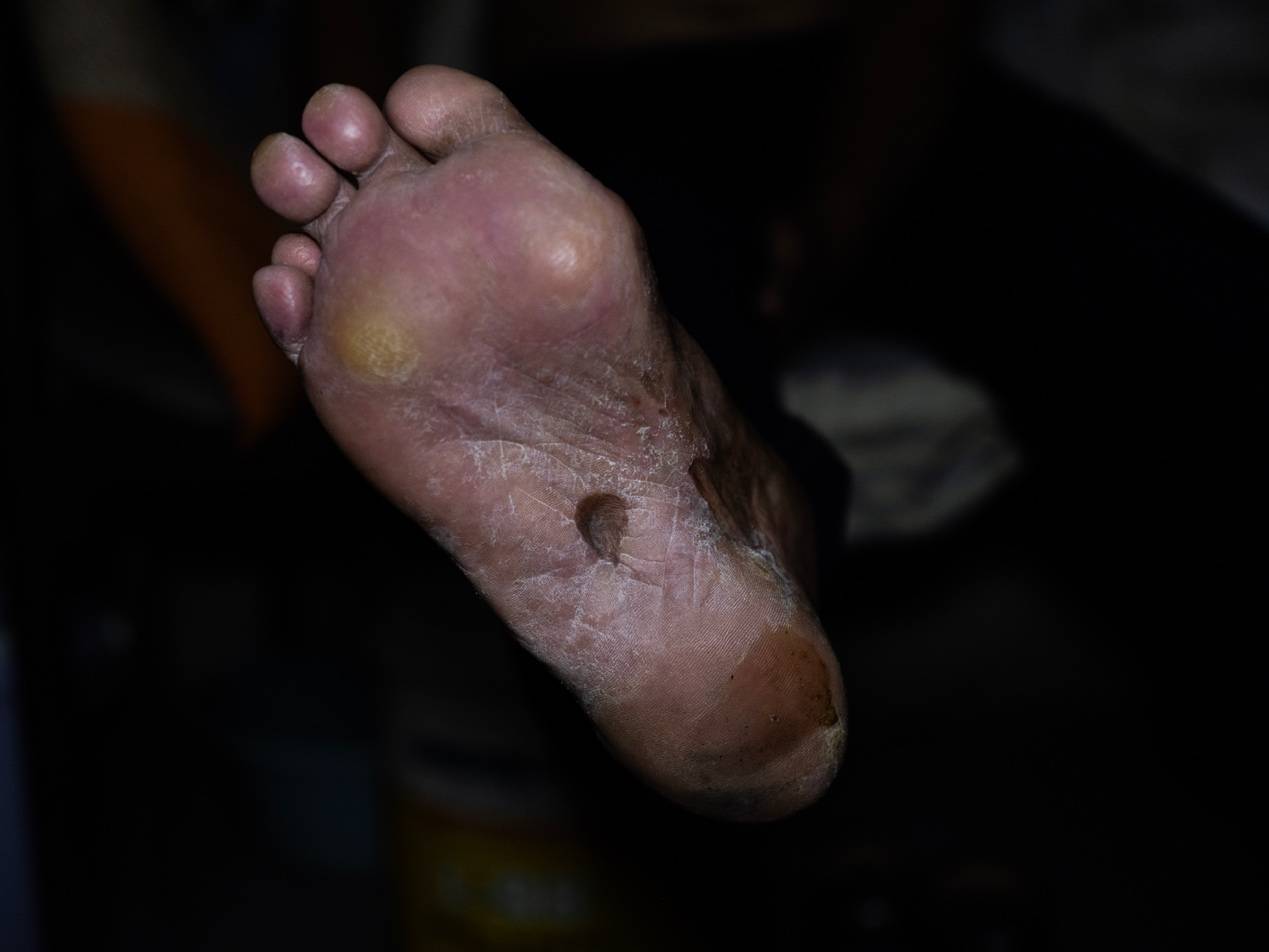 <strong></p>
<p>甘肃虚拟币挖矿</strong>他们挤在8元一晚的旅店 几百人抢一个活