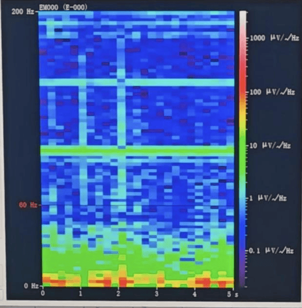 山西首例<strong></p>
<p>虚拟币回流</strong>!山西省人民医院成功实施脑机接口辅助功能区脑肿瘤切除手术