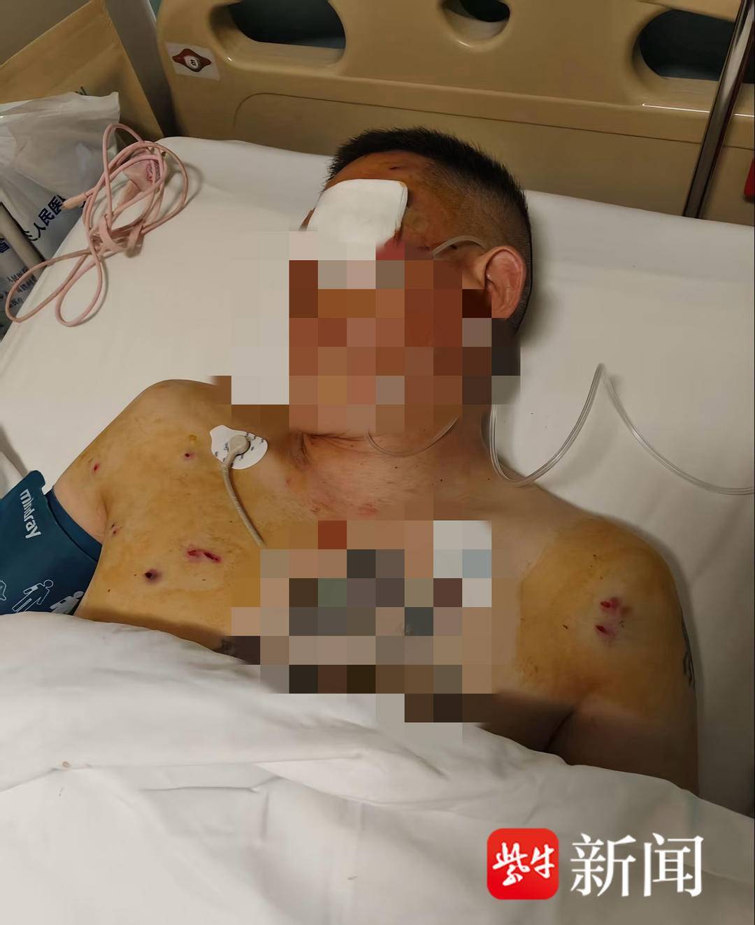 紫牛头条｜男子取款170万在银行门口遭抢劫致重伤<strong></p>
<p>金色财经</strong>，当事人认为银行保安未帮忙应担责